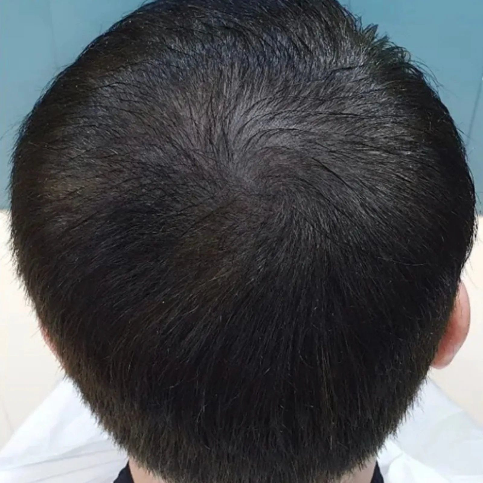 Perma Scalp After